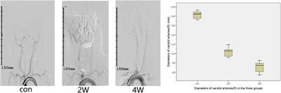 How to Establish a Minimal Invasive and Stable Carotid Artery Stenosis Rabbit Model? A Simple and Effective Carotid Artery Balloon Strain Technique